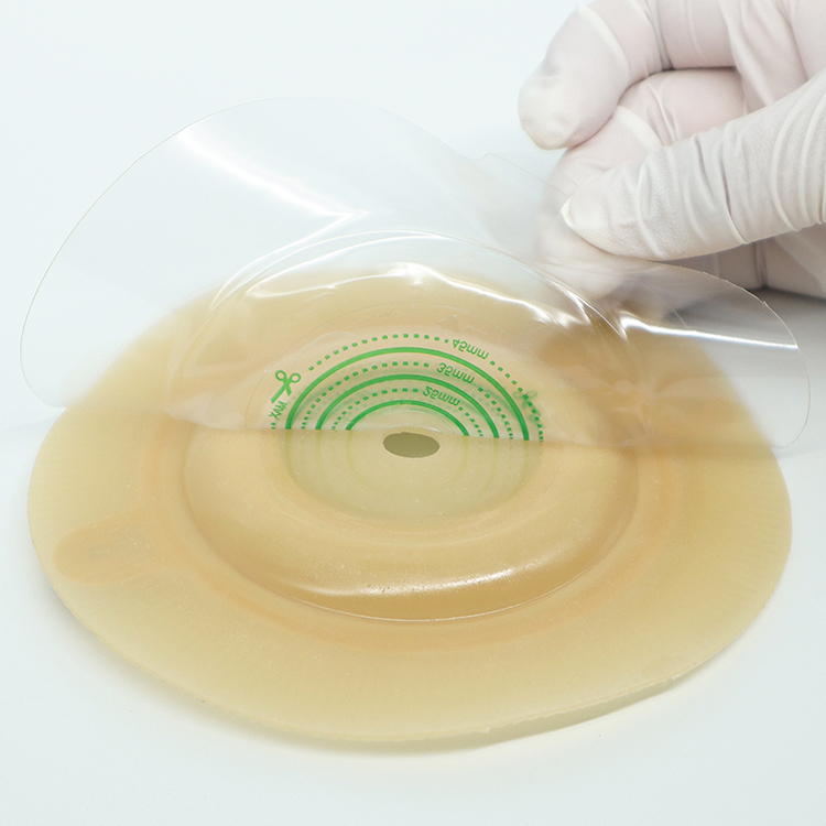 Perfect Fit and Anti Leakage Two-Piece Embedded Convex Hydrocolloid Skin Barrier 45mm