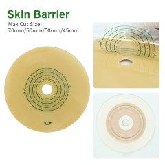 Hypoallergenic Two-Piece Embedded Hydrocolloid Skin Barrier 45mm 50mm 60mm 70mm