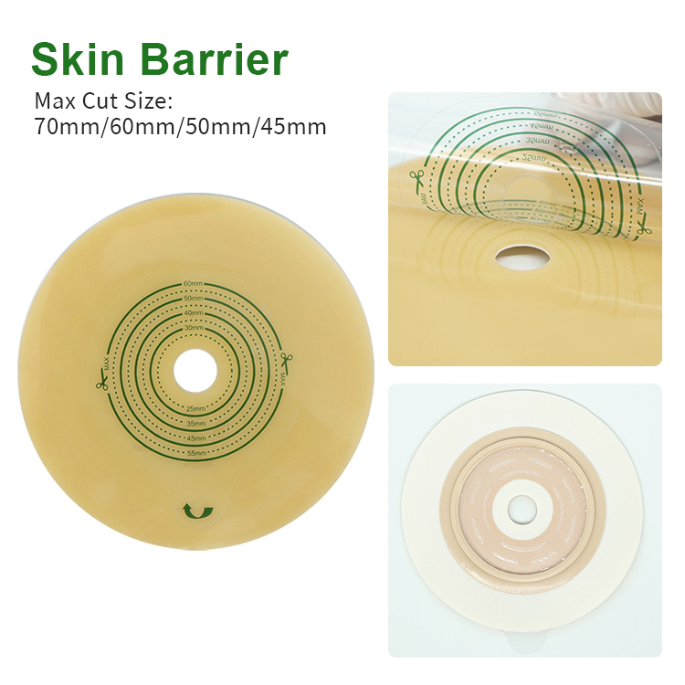 Hypoallergenic Two-Piece Embedded Hydrocolloid Skin Barrier 45mm 50mm 60mm 70mm