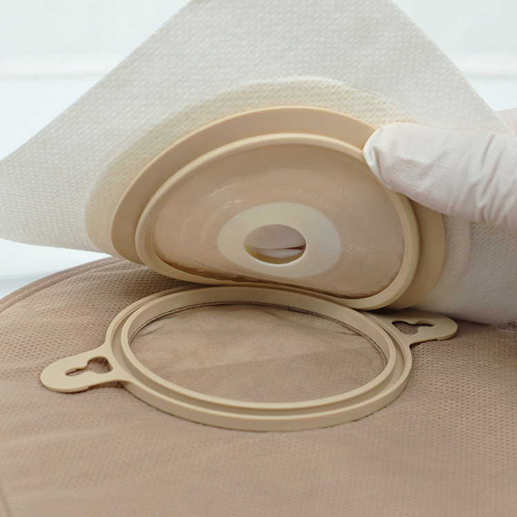 Anti-Curling Two-Piece Embedded Hydrocolloid Skin Barrier with Non-woven Bordered 45mm 50mm 60mm 70mm