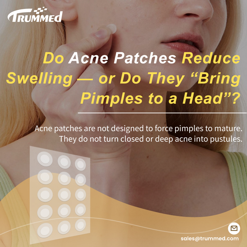 Do Acne Patches Reduce Swelling — or Do They “Bring Pimples to a Head”?