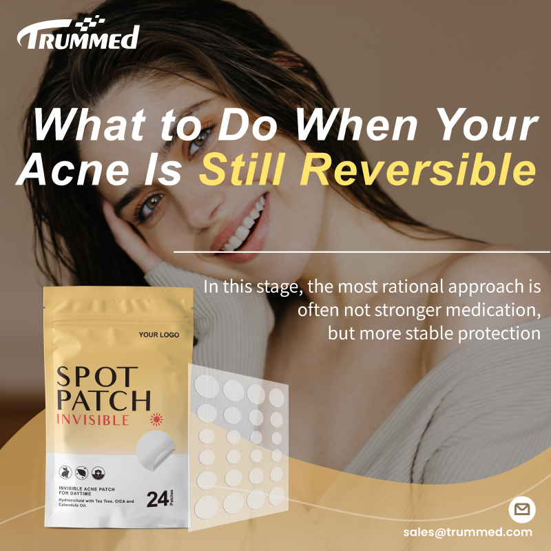What to Do When Your Acne Is Still Reversible