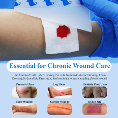 Trummed CMC Hydrofiber Wound Dressing CMC Fiber Dressing for Moderate to Heavy Exudate Wounds