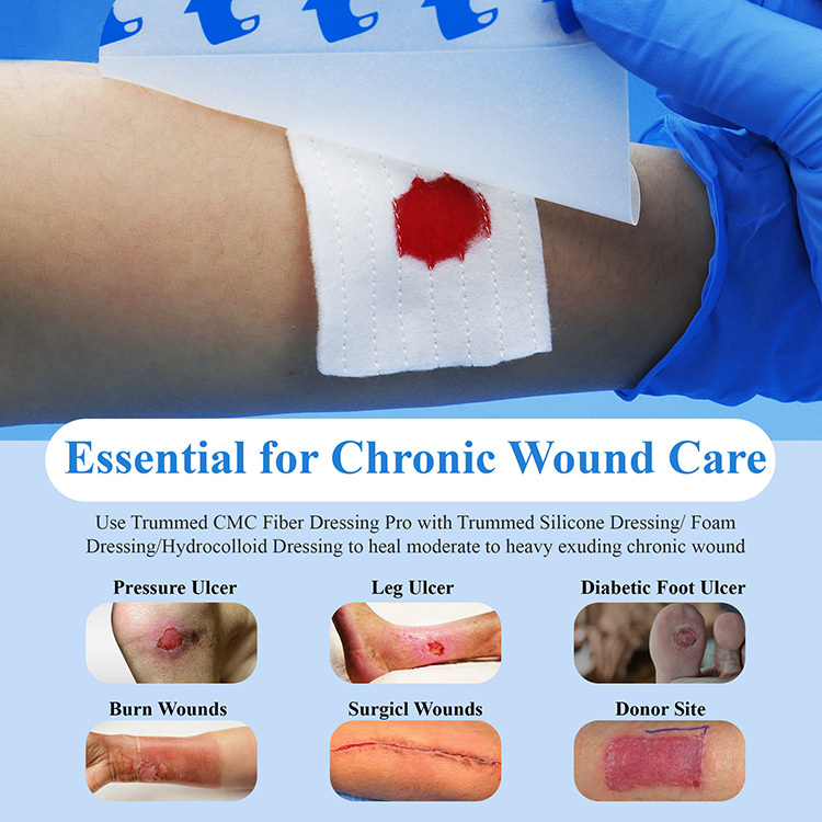 Trummed Carboxymethyl Cellulose CMC Fiber Wound Dressing Super Absorbent Gel Forming Fiber Dressing for Pressure Ulcers