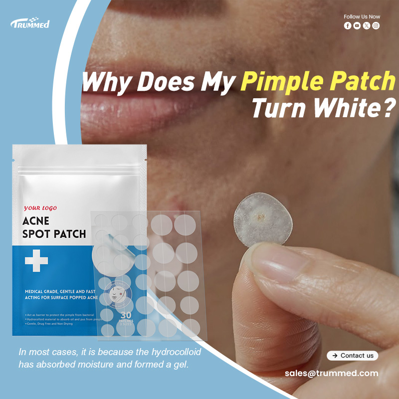 Why Does My Pimple Patch Turn White?