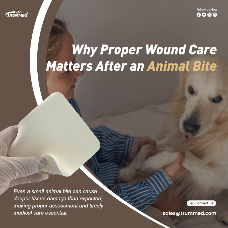 Why Proper Wound Care Matters After an Animal Bite
