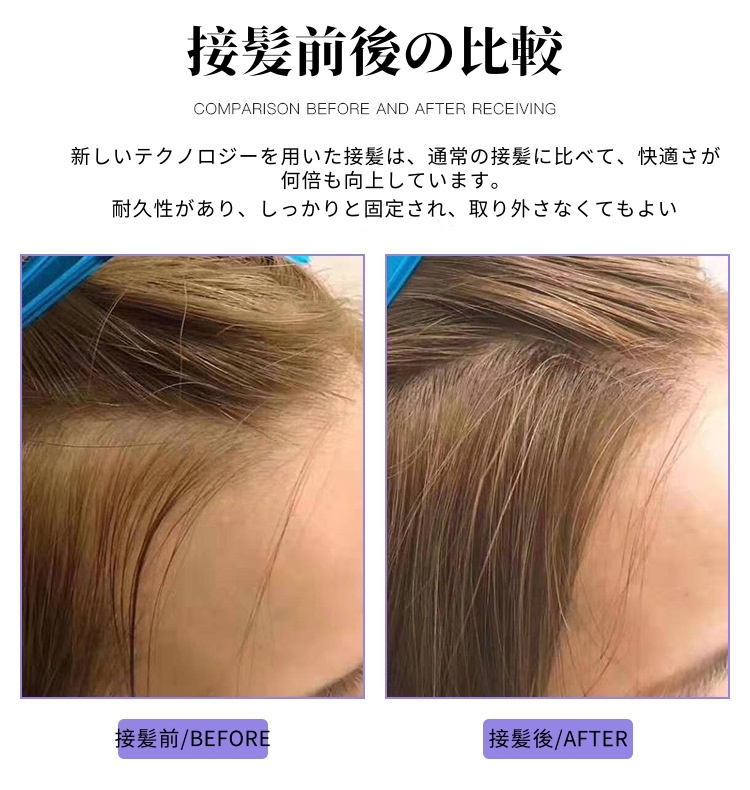 ゼロセンスヘアエクステンション、リアルヘア、トレースレス、ゼロセンス物理ヘアエクステンション、インスピレーションヘアエクステンション、マイクロタッチ、頭頂部に前髪のある和風のインビジブルヘアエクステンション