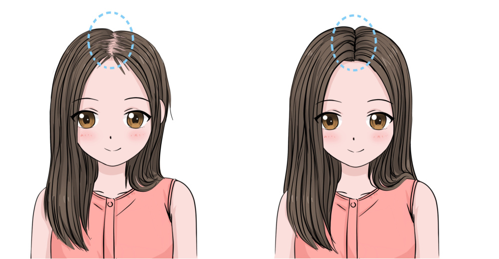 ゼロセンスヘアエクステンション、リアルヘア、トレースレス、ゼロセンス物理ヘアエクステンション、インスピレーションヘアエクステンション、マイクロタッチ、頭頂部に前髪のある和風のインビジブルヘアエクステンション