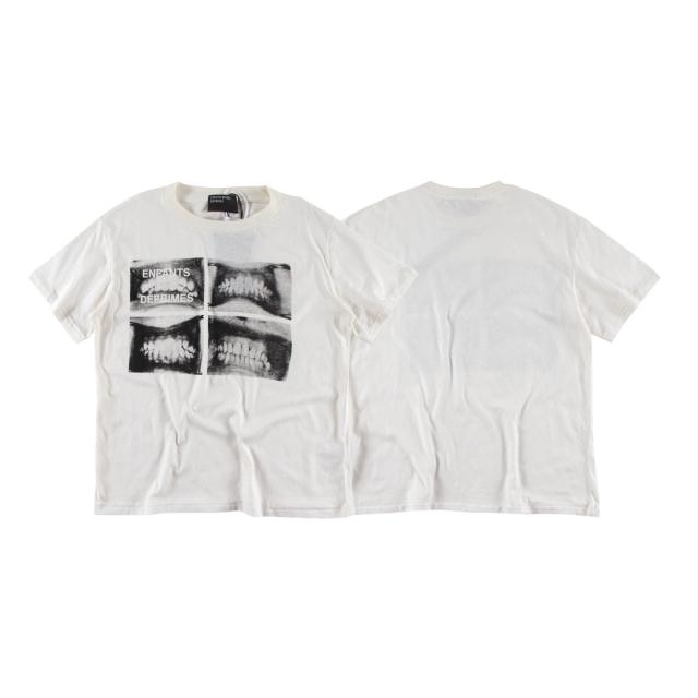 ERD Enfants Riches Déprimés Four Grid Dental X-Ray Teeth Print Tee