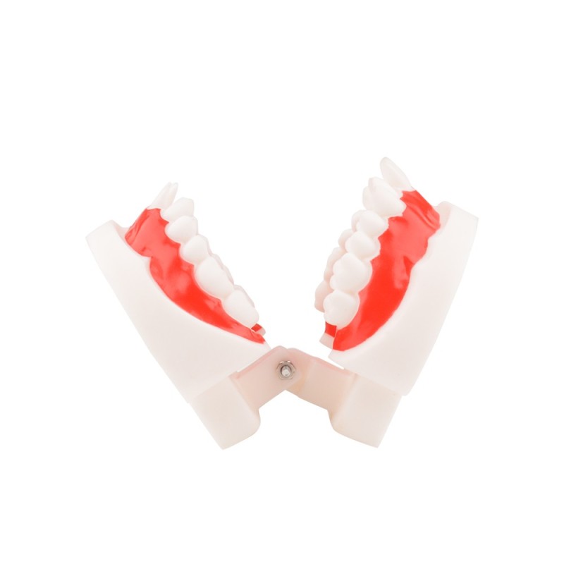 Dental Malocclusion Teeth Model - Distal, Mesial Occlusion Demonstration