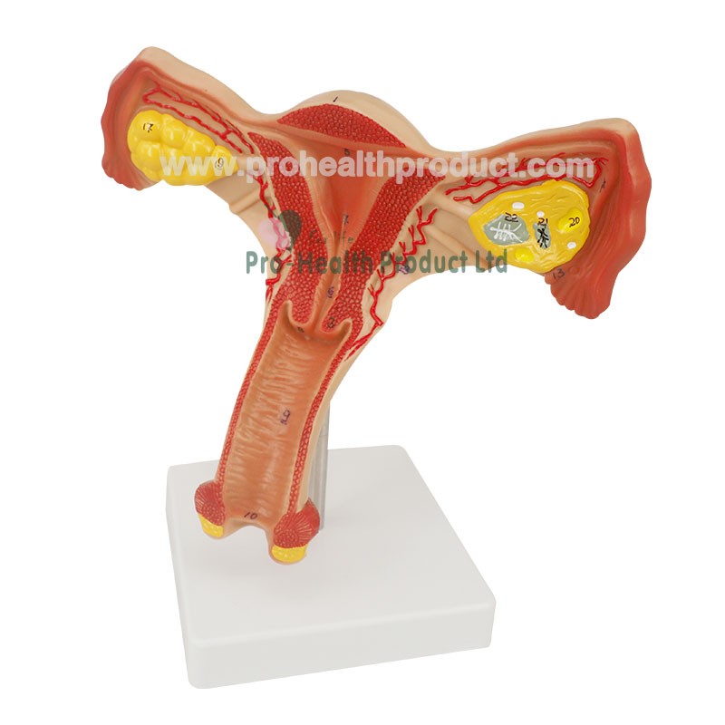 Normal Uterus Ovary Anatomy Model