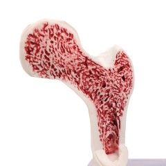 Menopausal Osteoporosis Model (Femur & 4 Vertebrae) for Medical Teaching