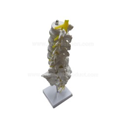 Lumbar Spine Model with 5 Lumbar Vertebrae on Removable Base