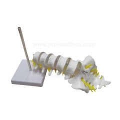 Lumbar Spine Model with 5 Lumbar Vertebrae on Removable Base