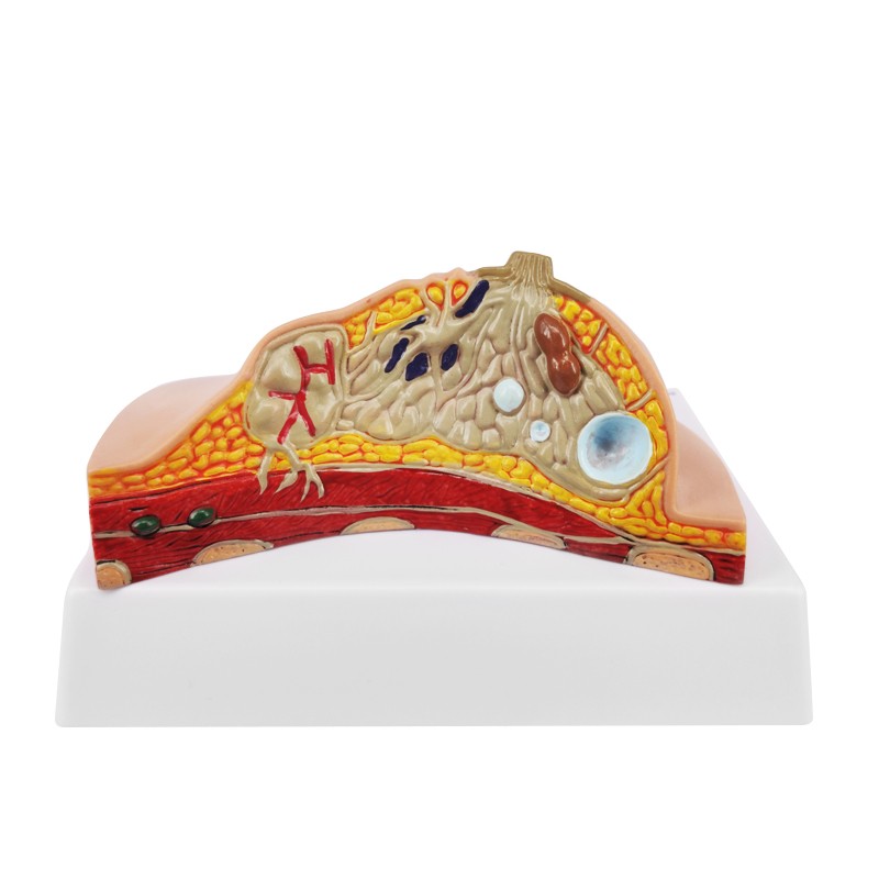 Breast Cross-Section Anatomy Model with Common Pathologies