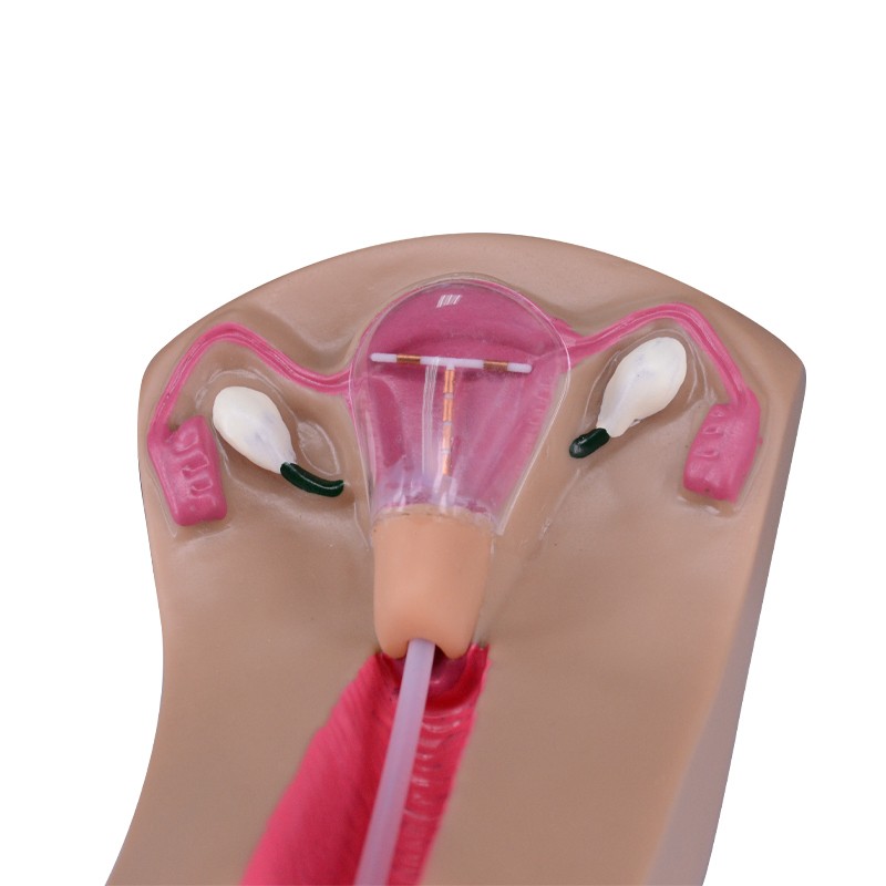 IUD Training Simulator for IUD Insertion Training