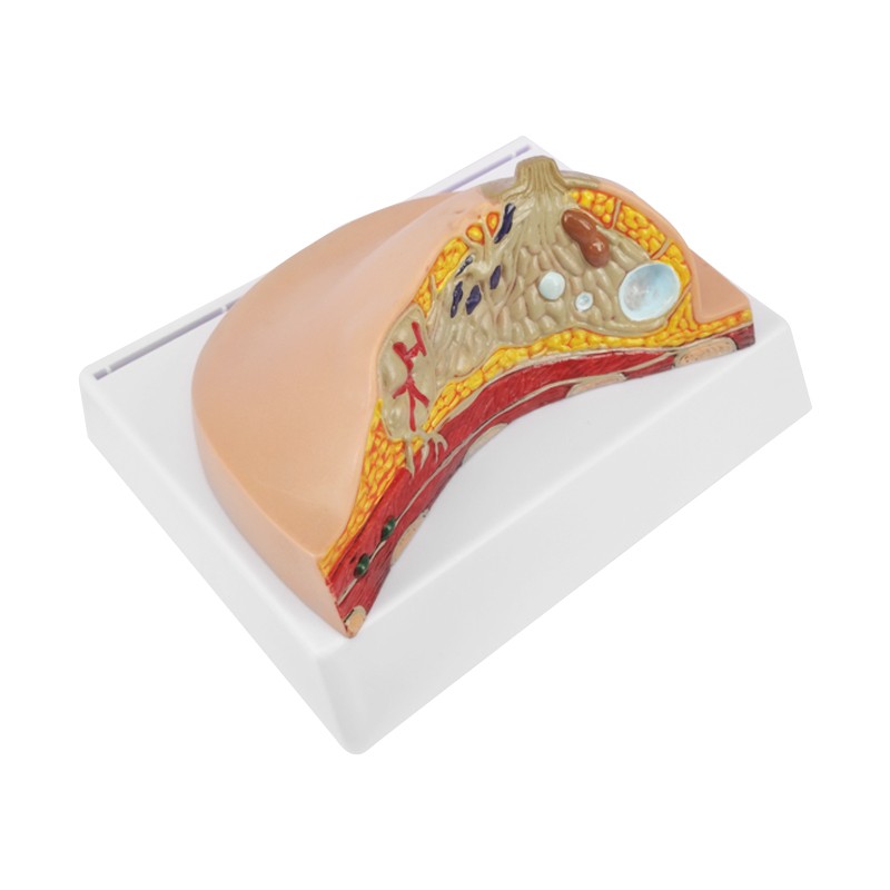 Breast Cross-Section Anatomy Model with Common Pathologies
