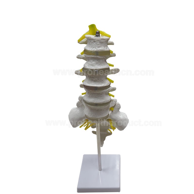 Lumbar Spine Model with 5 Lumbar Vertebrae on Removable Base