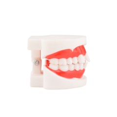 Dental Malocclusion Teeth Model - Distal, Mesial Occlusion Demonstration