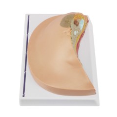 Breast Cross-Section Anatomy Model with Common Pathologies