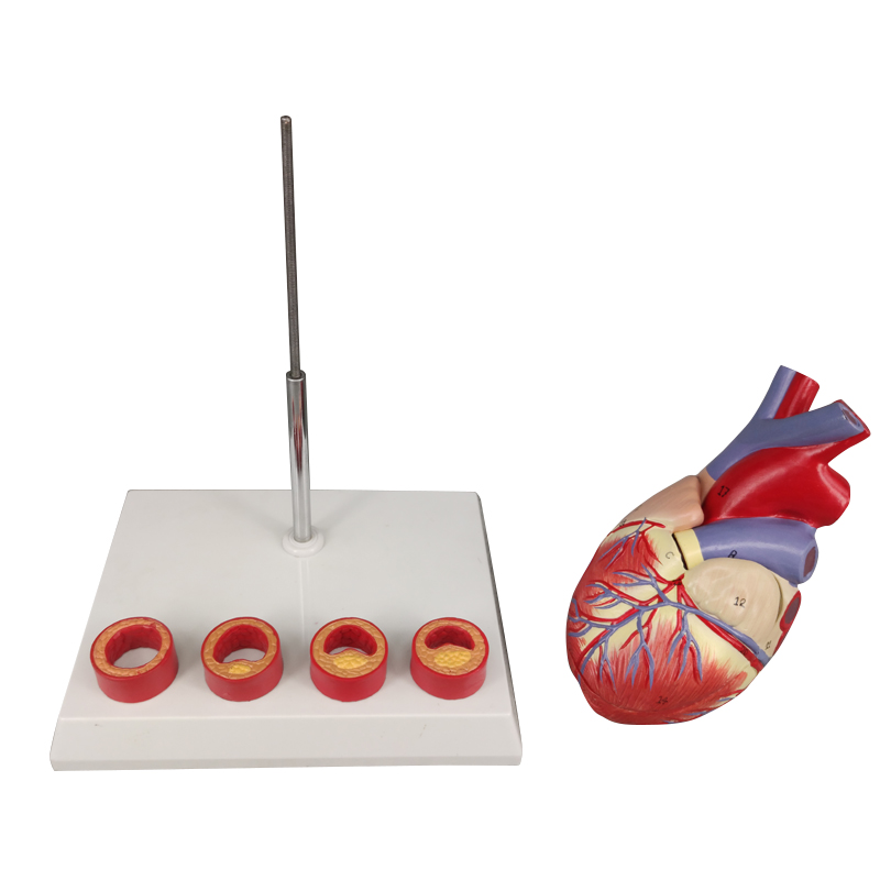 Heart Atherosclerosis model