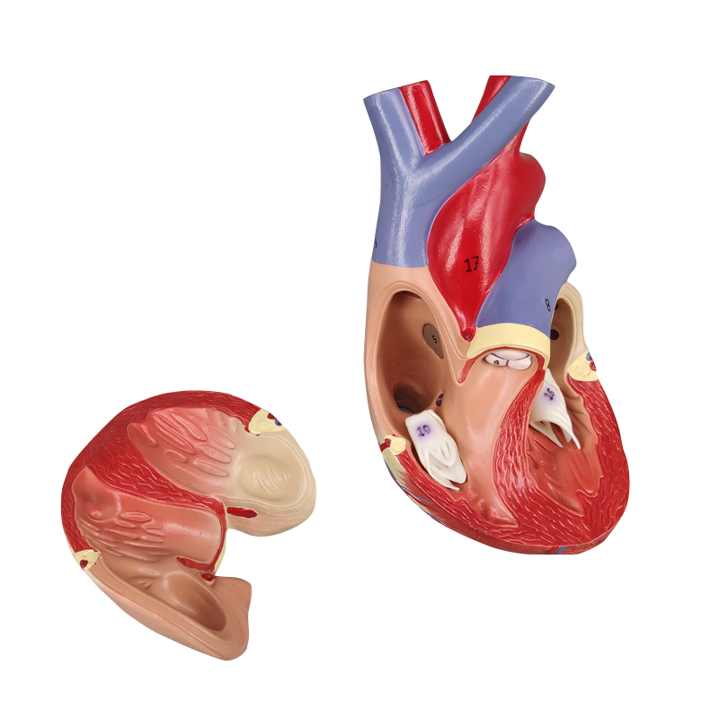 Heart Atherosclerosis model