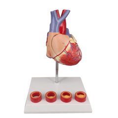 Heart Atherosclerosis model