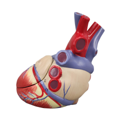 Heart Atherosclerosis model