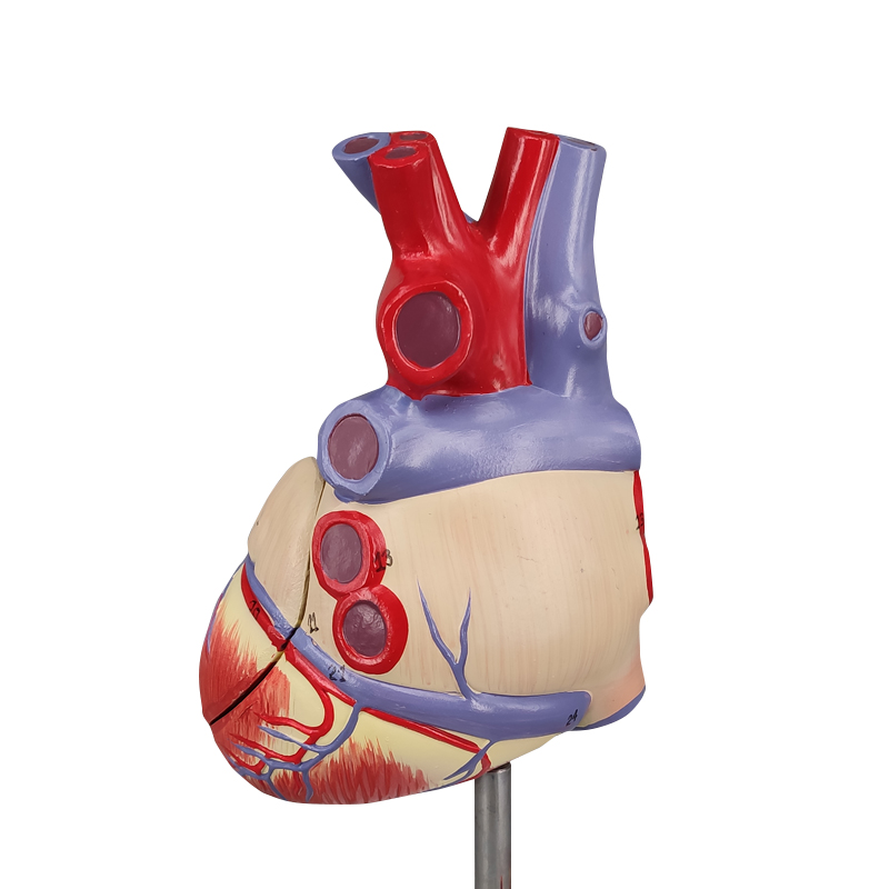 Heart Atherosclerosis model