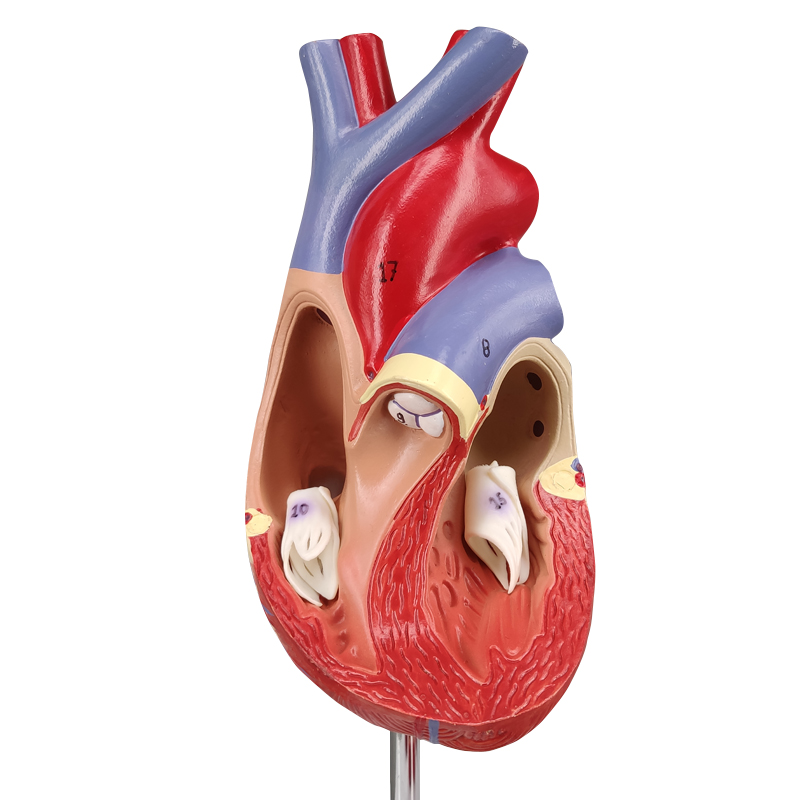 Heart Atherosclerosis model