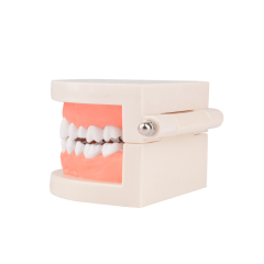 Standard Dental Tooth Decay Study Model, 1:1 Life Size Child