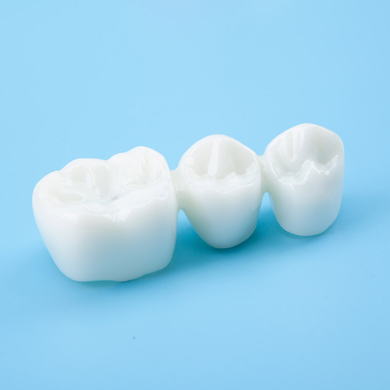 Removal Implant Teeth Model, 4 Times for Patient Education