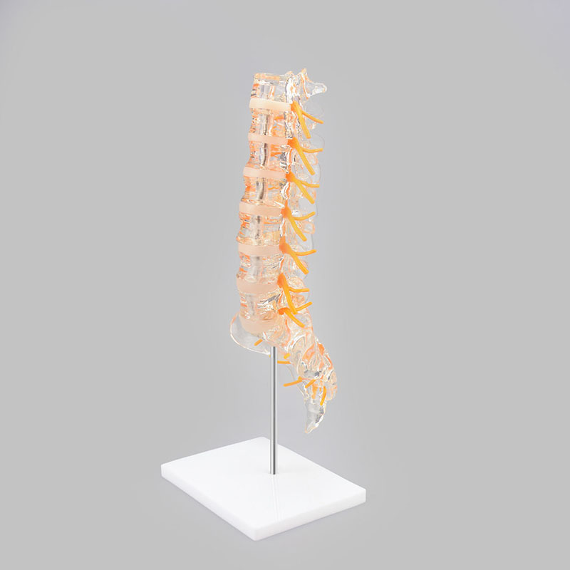 Clear Lumbar Spine Model with Sacrum, Life Size for Medical Education