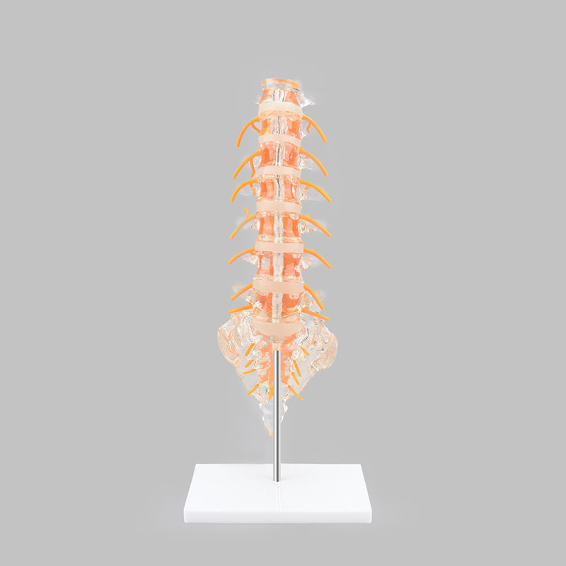 Clear Lumbar Spine Model with Sacrum, Life Size for Medical Education