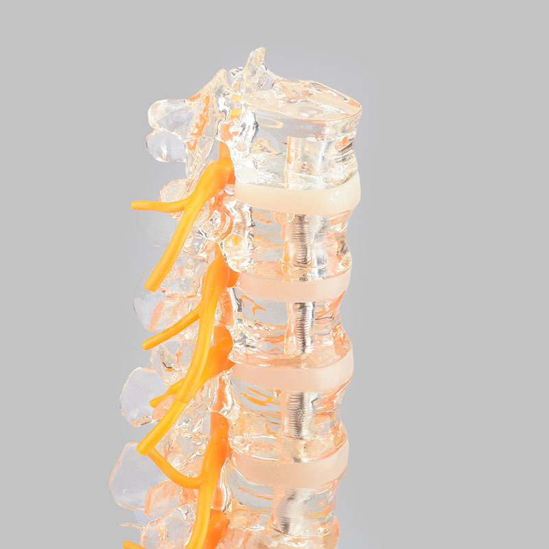 Clear Lumbar Spine Model with Sacrum, Life Size for Medical Education