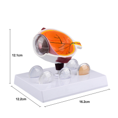 Oversized Human Cataract Eye Anatomy Model for Patient Education