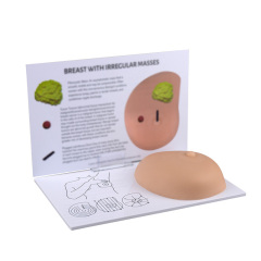 Breast Self Exam(BSE) Model with Irregular Masses