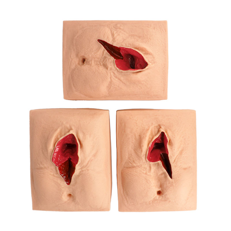Episiotomy & Perineal Laceration Simulator for Medical Demonstration