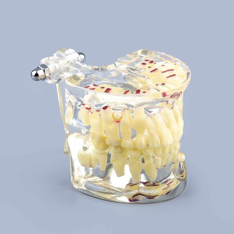 Clear Teaching Disease Teeth Model with Deciduous Teeth