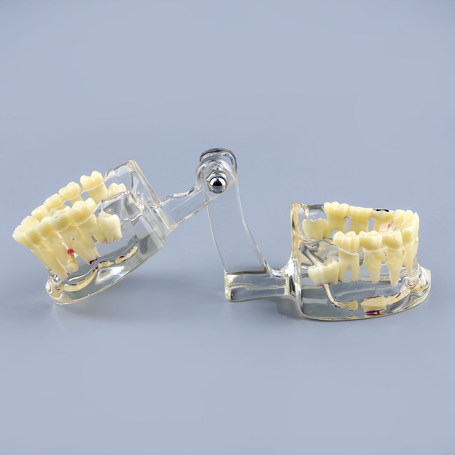 Clear Teaching Disease Teeth Model with Deciduous Teeth