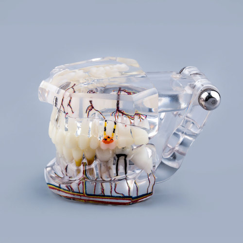 Transparent Pathological Teeth Root Model with Dental Implants