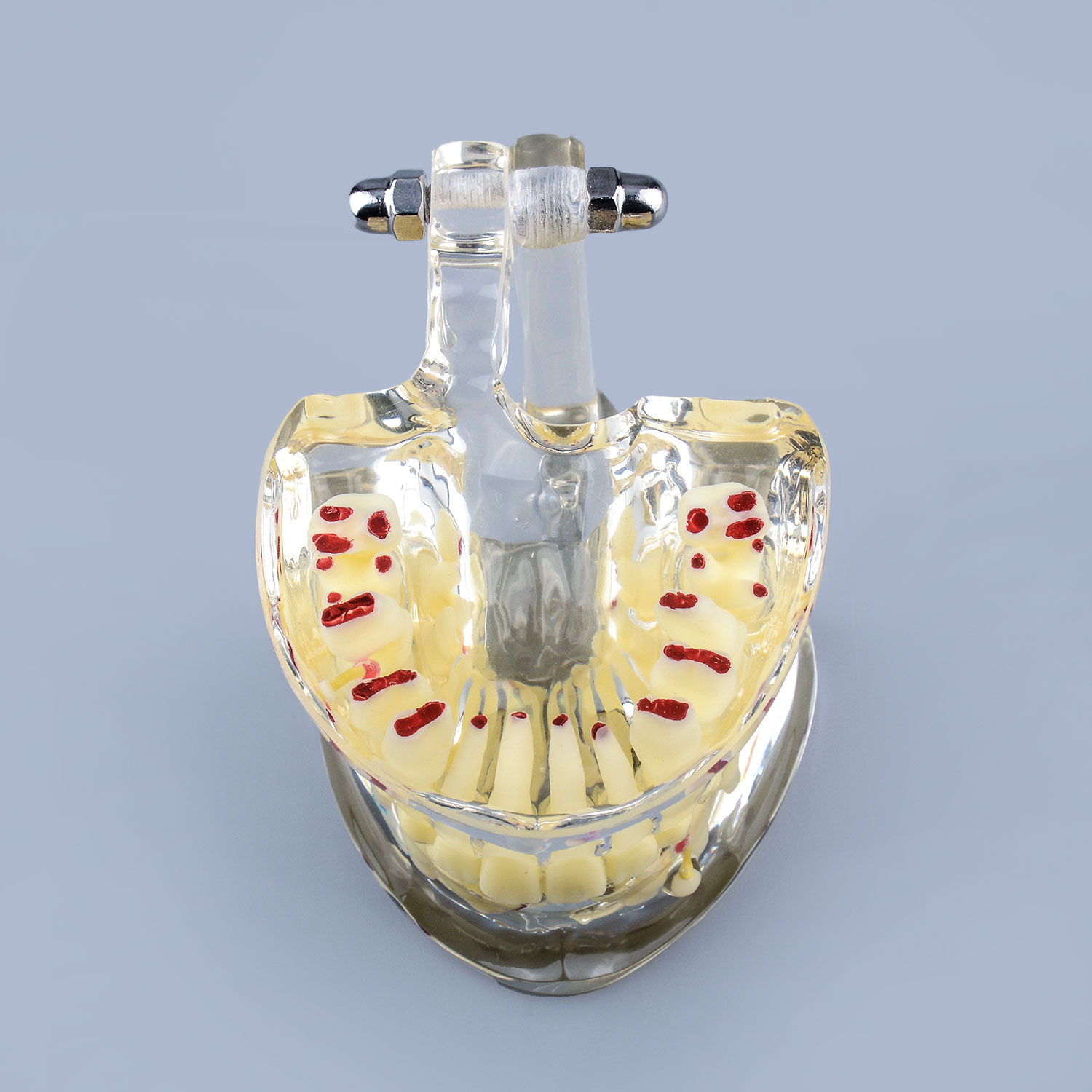 Clear Teaching Disease Teeth Model with Deciduous Teeth