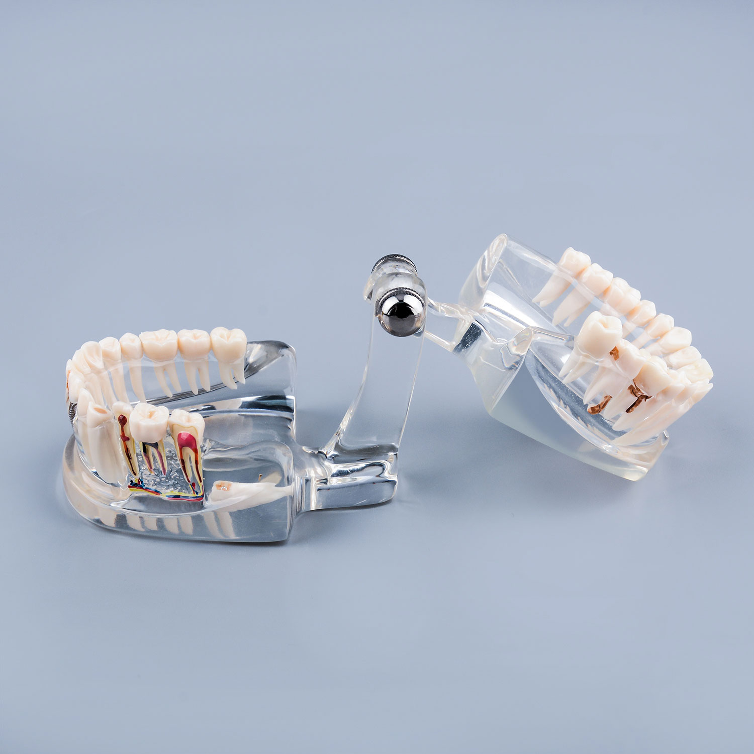 Transparent Disease Teeth Model Missing Gum for Patient & Student Education