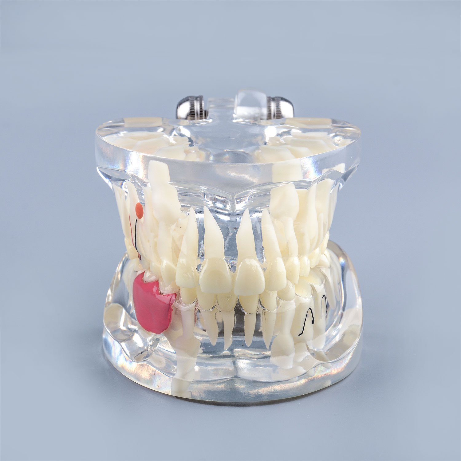 Clear Pathology Teeth Model with Broken Tooth, Root and Gum