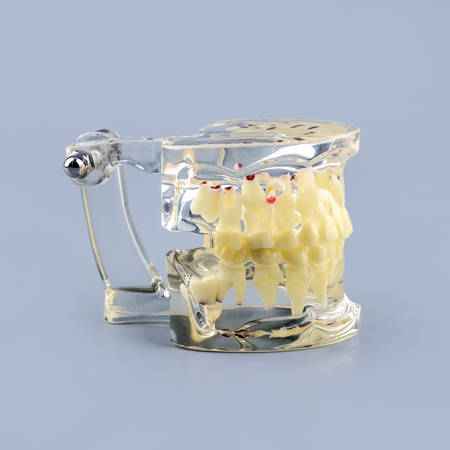 Clear Teaching Disease Teeth Model with Deciduous Teeth