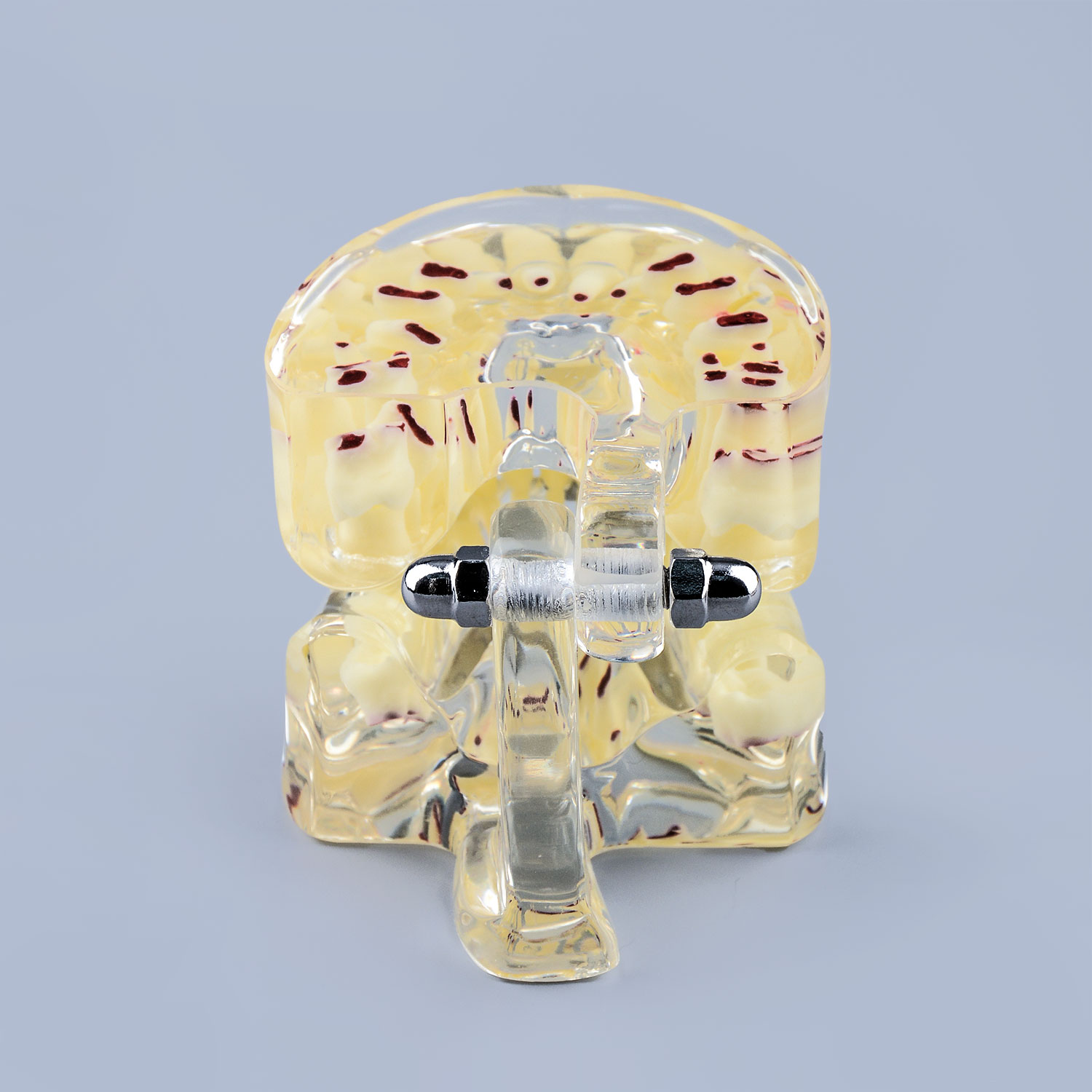 Clear Teaching Disease Teeth Model with Deciduous Teeth