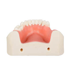 Human Mandible Implant Training Model Missing 47, 46, 45, 35 Teeth