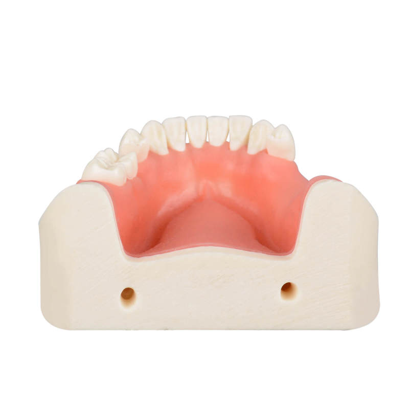 Human Mandible Implant Training Model Missing 47, 46, 45, 35 Teeth
