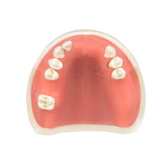 Maxillary Implant Surgery Practice Model, Missing 17, 12, 11, 21, 22, 26, 27 Teeth