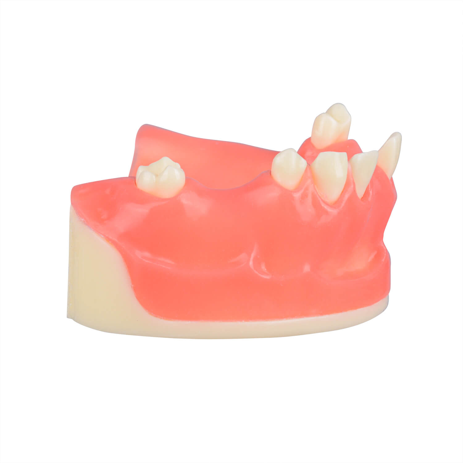 Orthognathic Surgery Maxillary Sinus Lift Training Model, Missing Teeth 12, 13, 15, 16, 17, 21, 25, 26